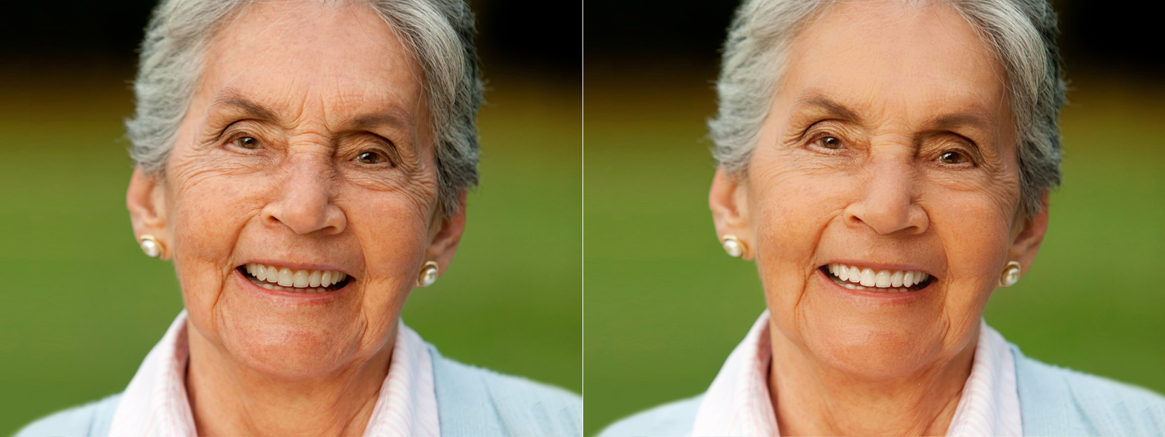 Imágen del antes y después del retoque facial con Makeup.Pho.to