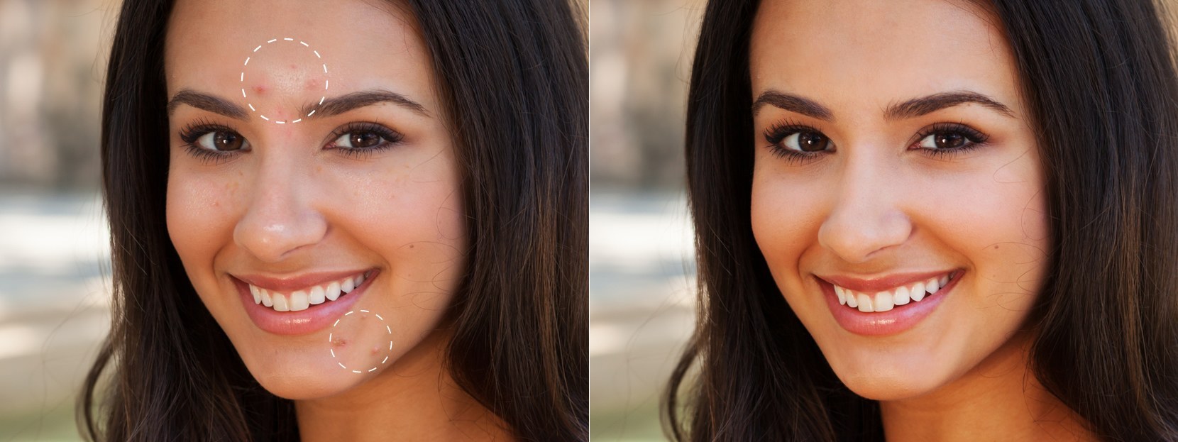 Retouch Skin In Photo Remove Pimples Blackheads Acne Blemishes retouch skin in photo remove pimples