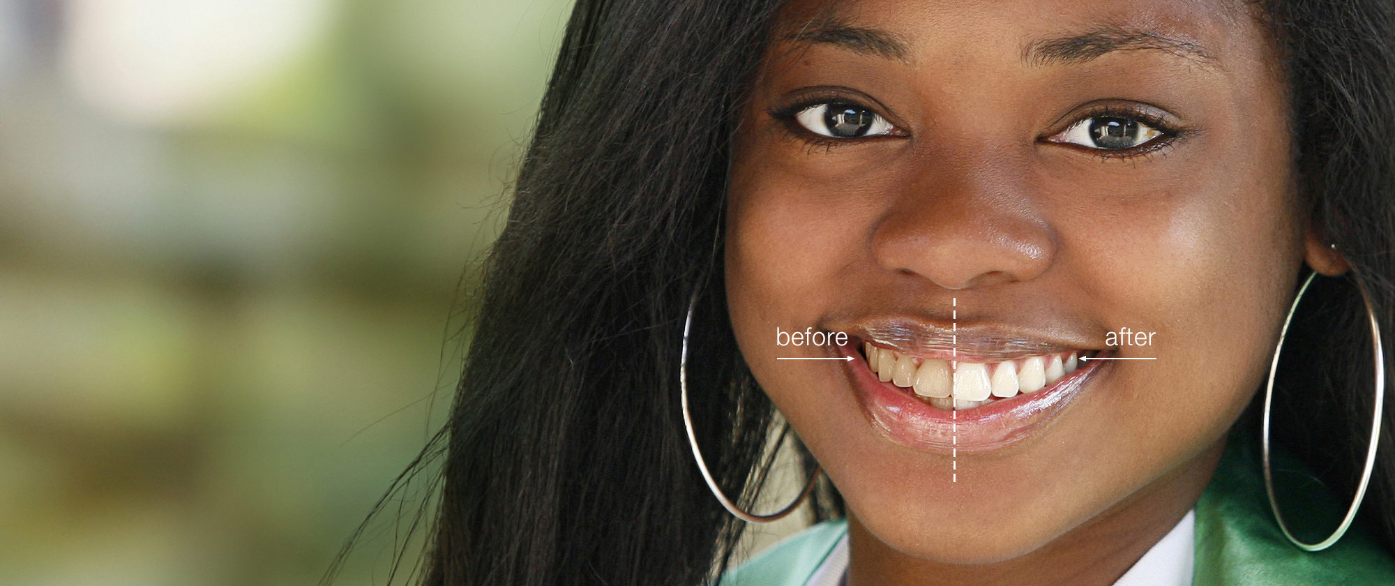 Whiten teeth in a photo get whiter eyes for a beautiful portrait